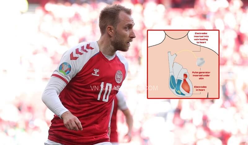 Eriksen được cấy máy khử rung tim