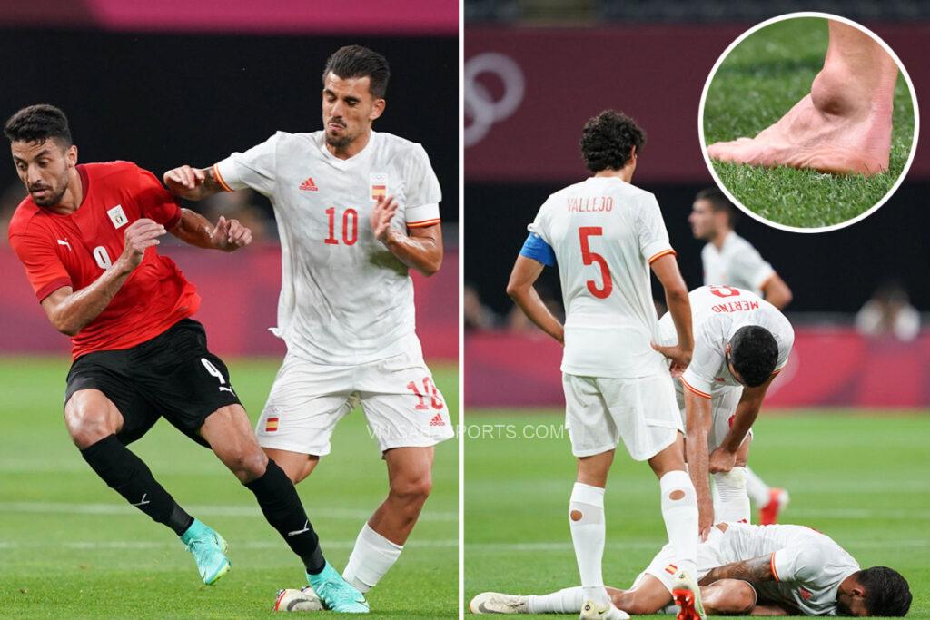 Dani Ceballos đã bị rách dây chằng sau va chạm nguy hiểm ở Olympic