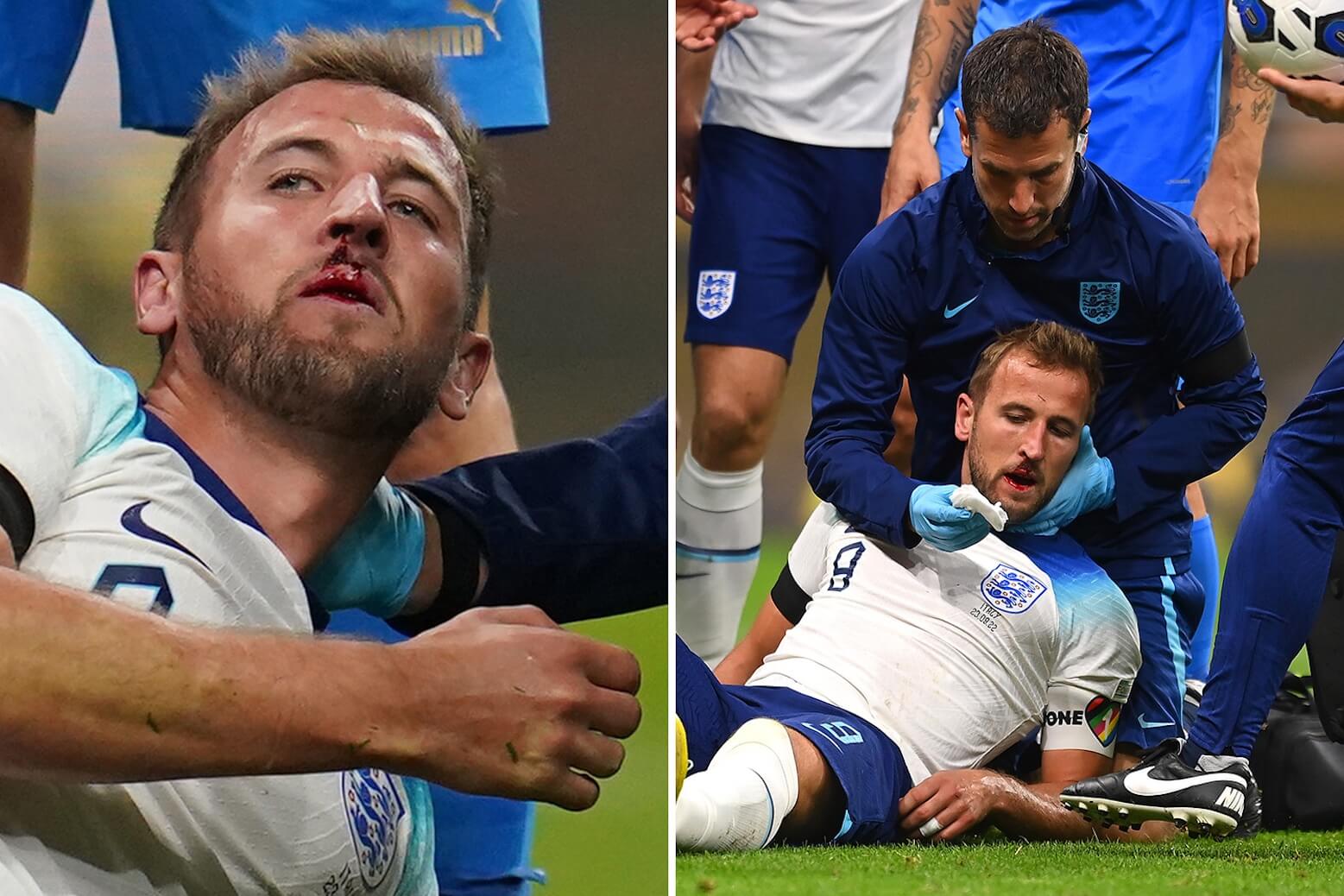 Ngoại hạng Anh liên tục báo hại ĐT Anh trước World Cup 2022